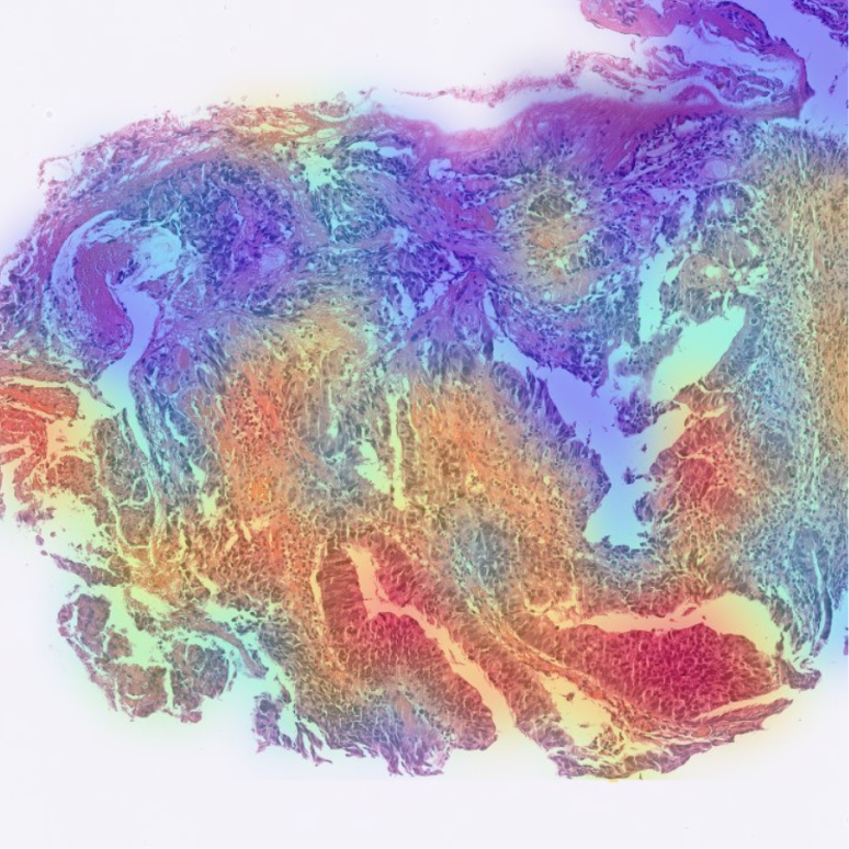 PathoAiD®-Colon Dx